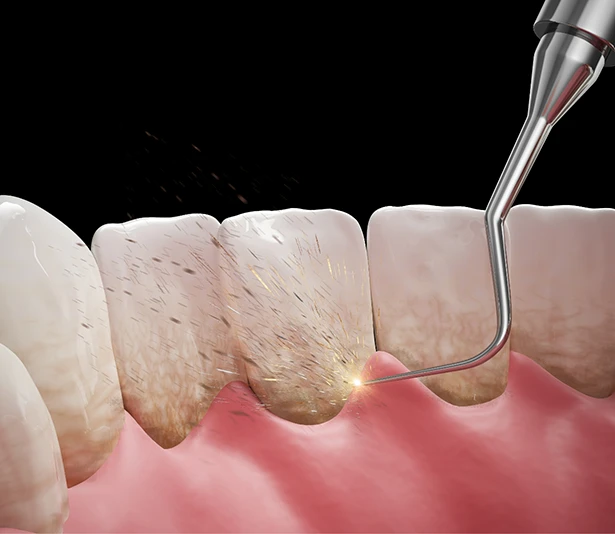 Dentist examining gums